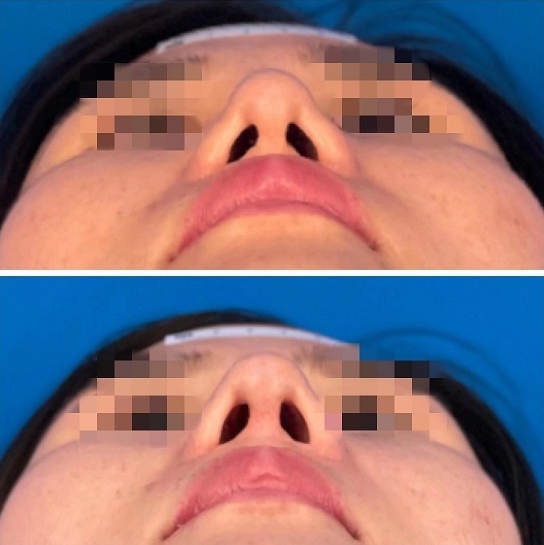 11.png